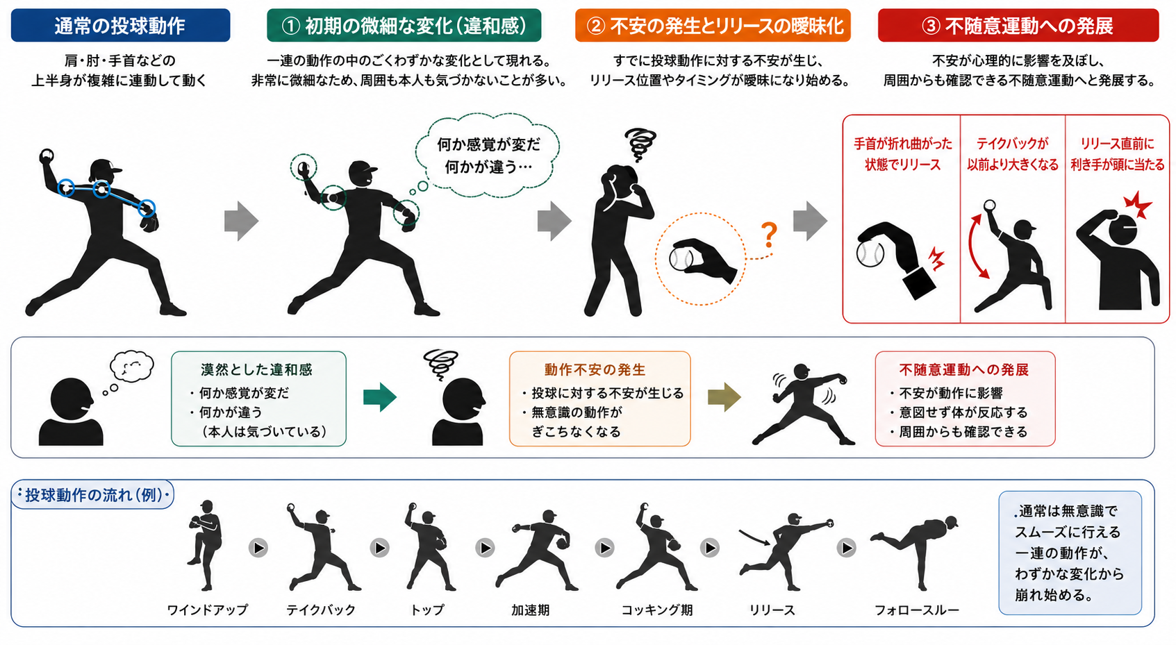 イップス なり やすい 人
